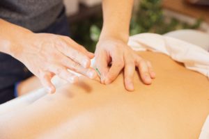 practitioner giving acupuncture treatment on back